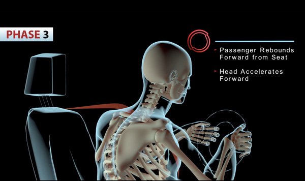 The third phase of whiplash: neck and skeleton response