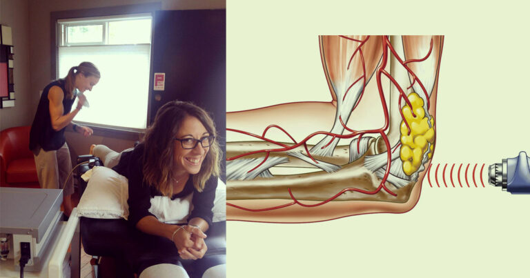 Ashley Scopick gets Shockwave Therapy to promote healing.